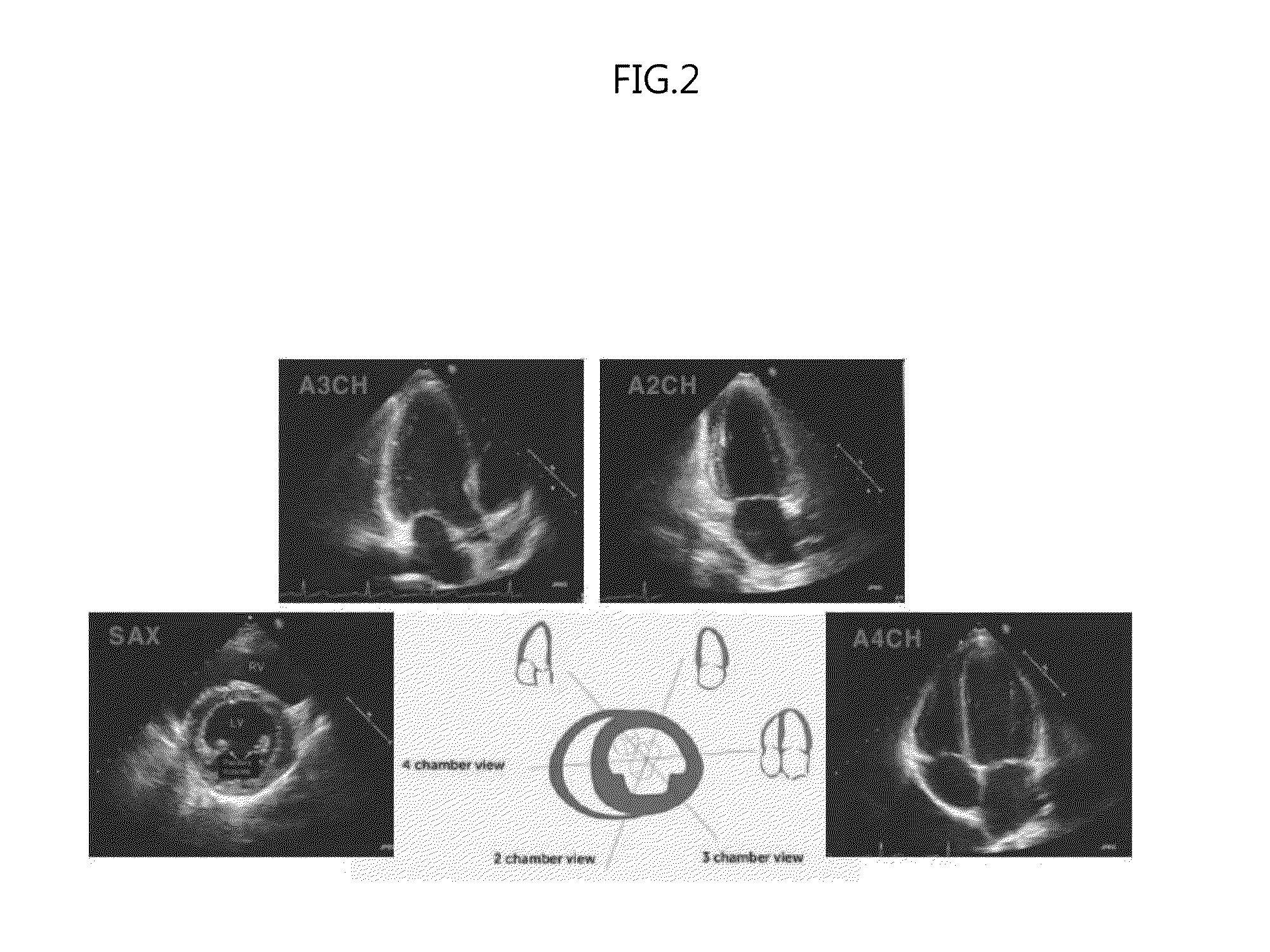 Apparatus and method for processing echocardiogram using navier-stokes equation