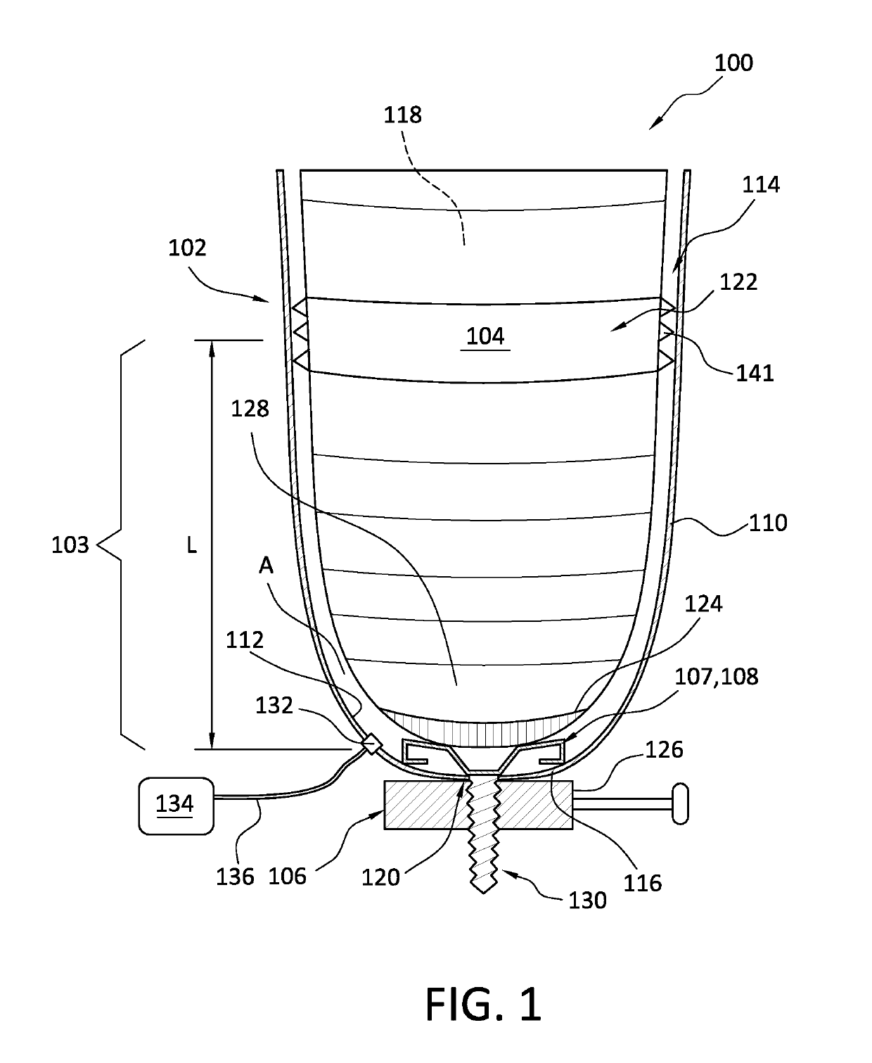 Prosthetic socket system