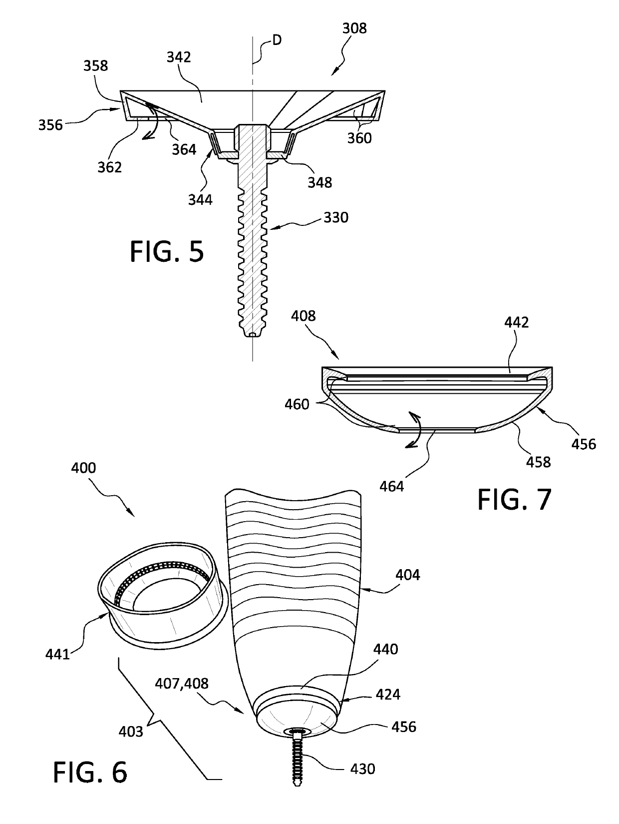 Prosthetic socket system