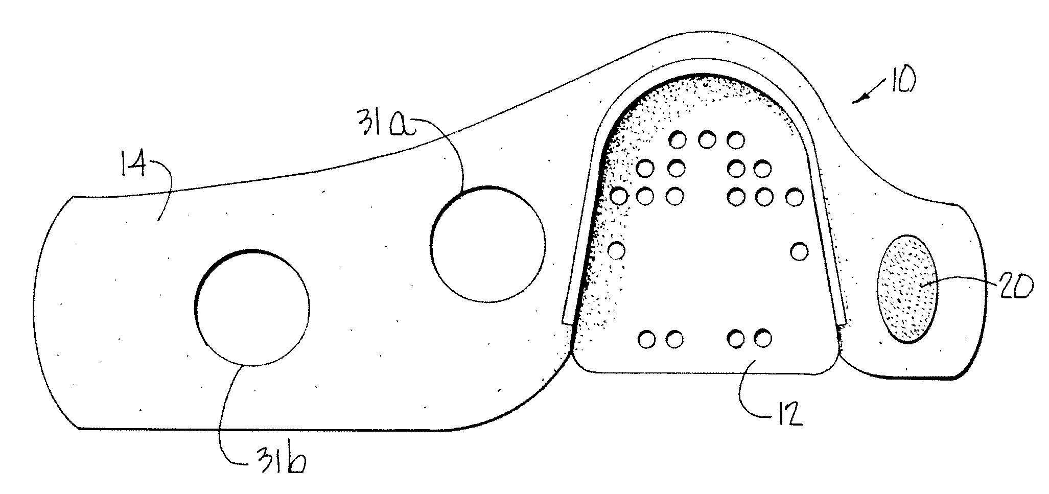 Site guard for intravenous sites and other sensitive areas