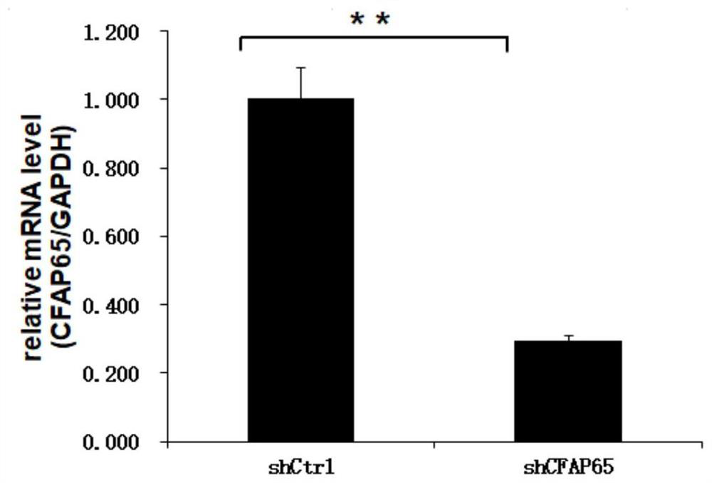 Application of human CFAP65 gene and related products