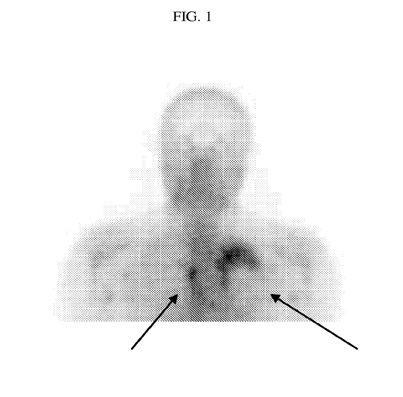 Folate-targeted diagnostics and treatment