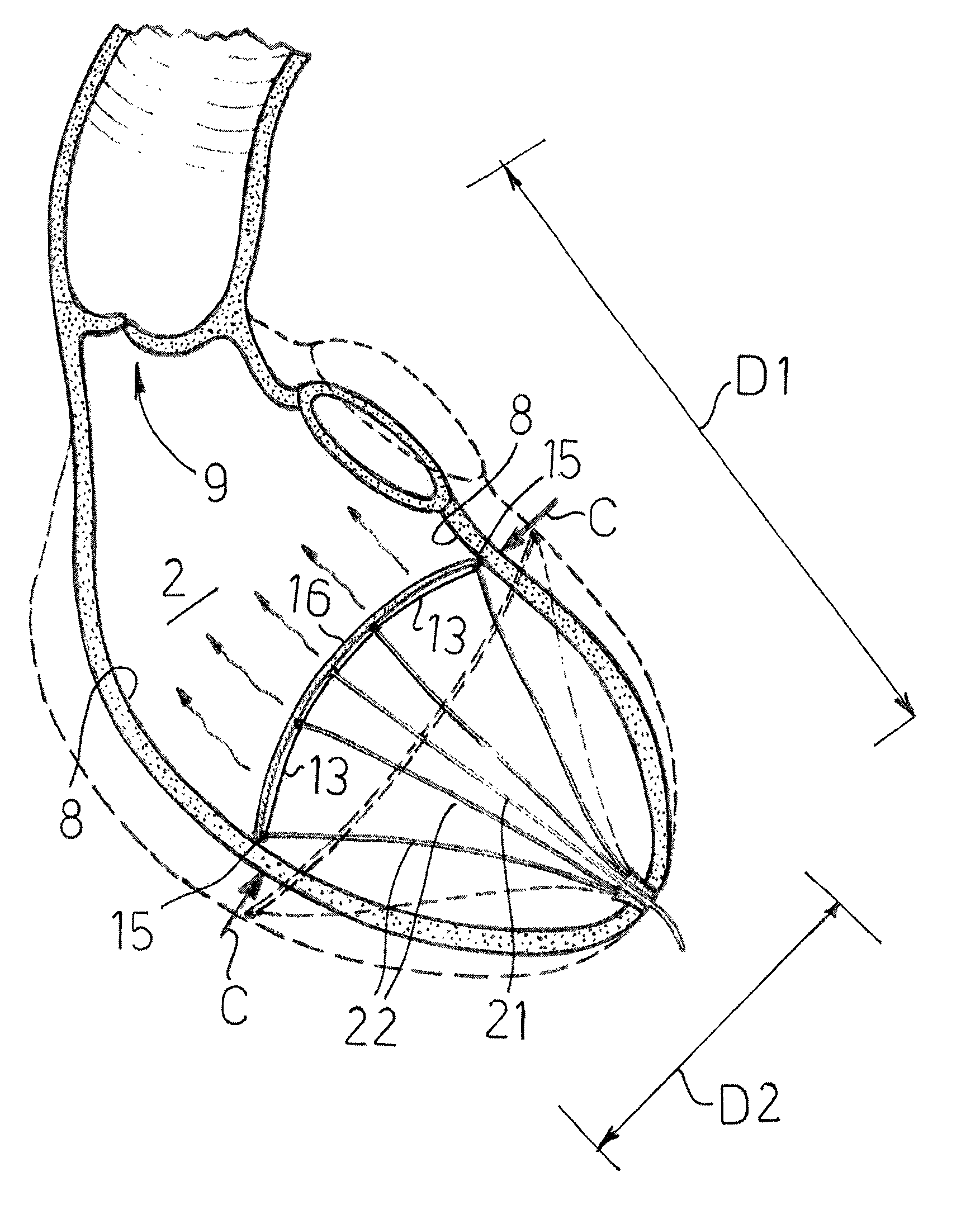 Cardiovascular device