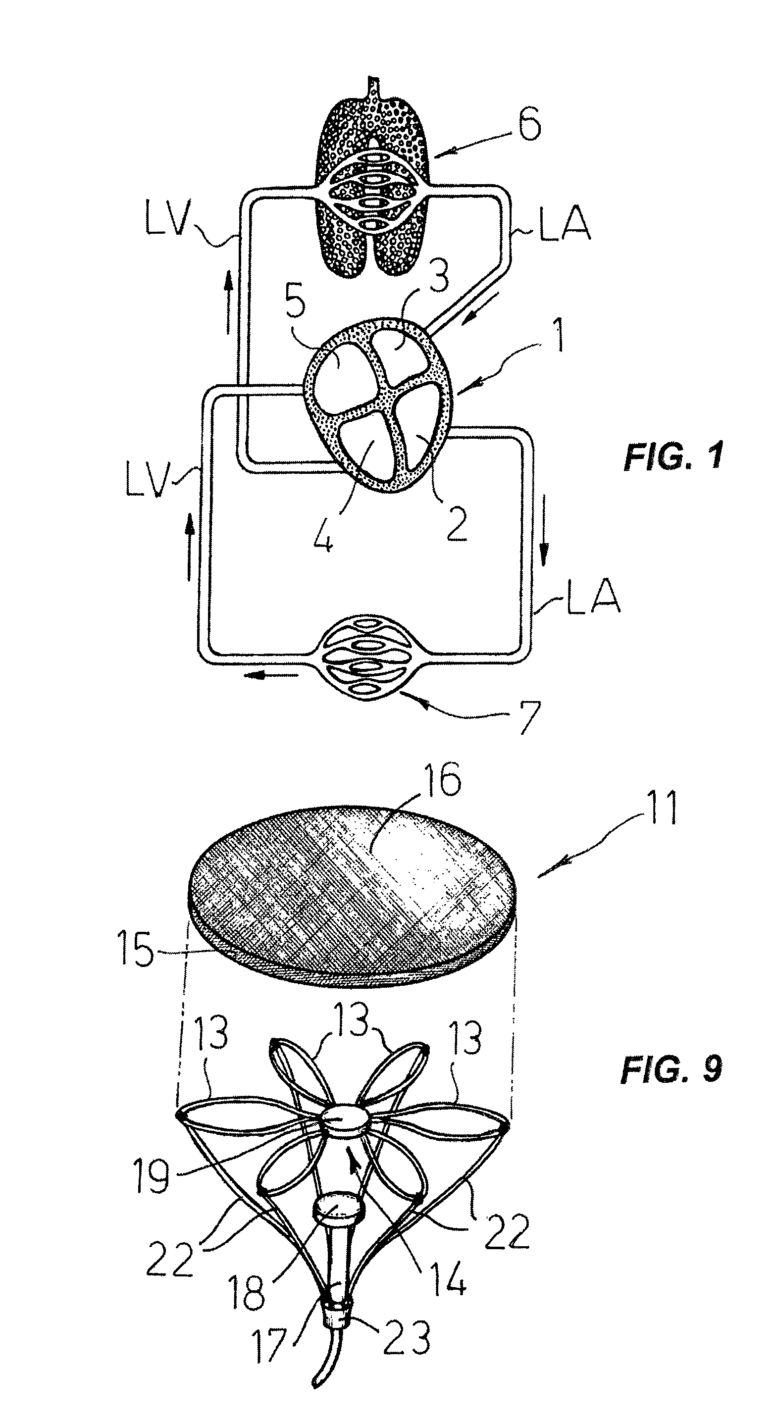 Cardiovascular device