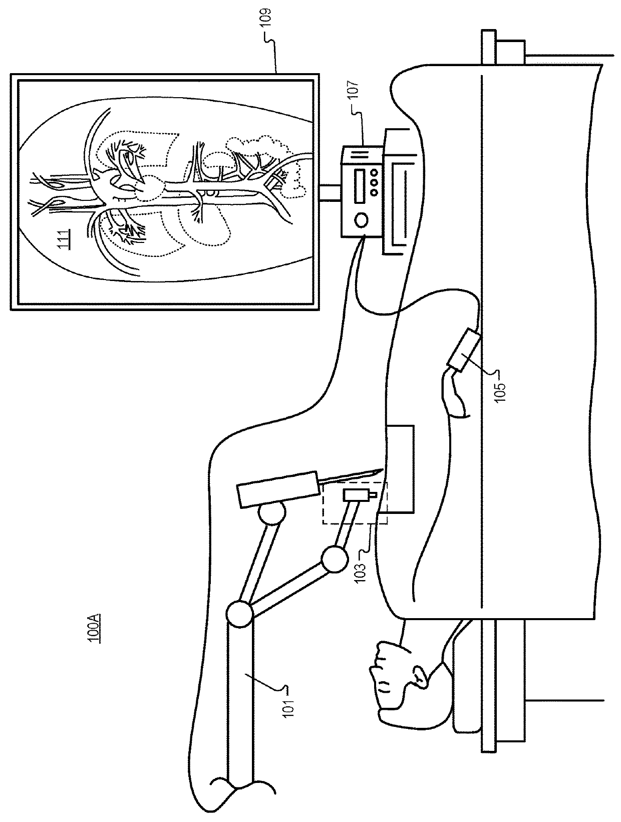 Detection of Blood Vessels