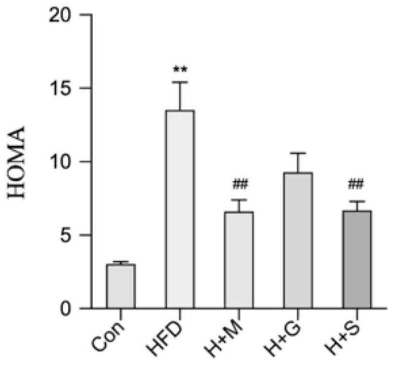 Synbiotic composition and preparation method and application thereof