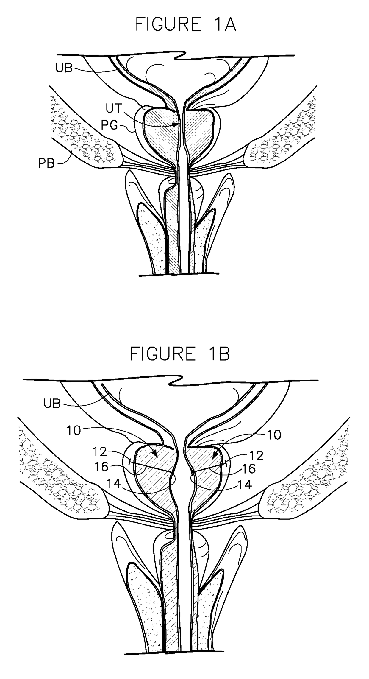 System with reloadable handle for delivering an anchor