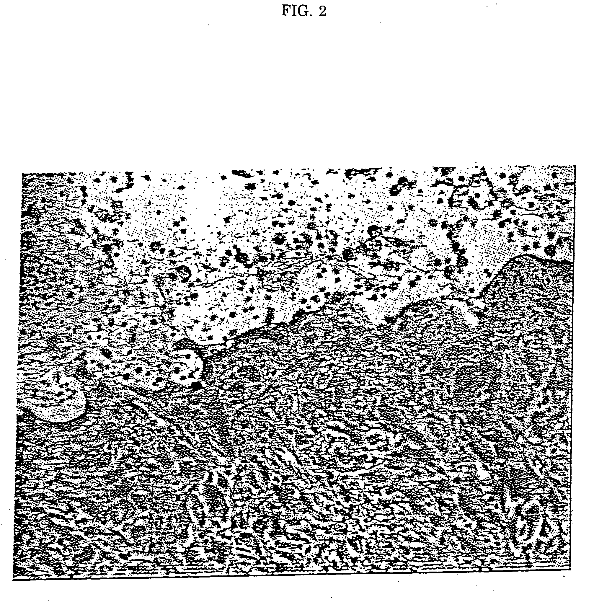 Method for inhibiting bone resorption