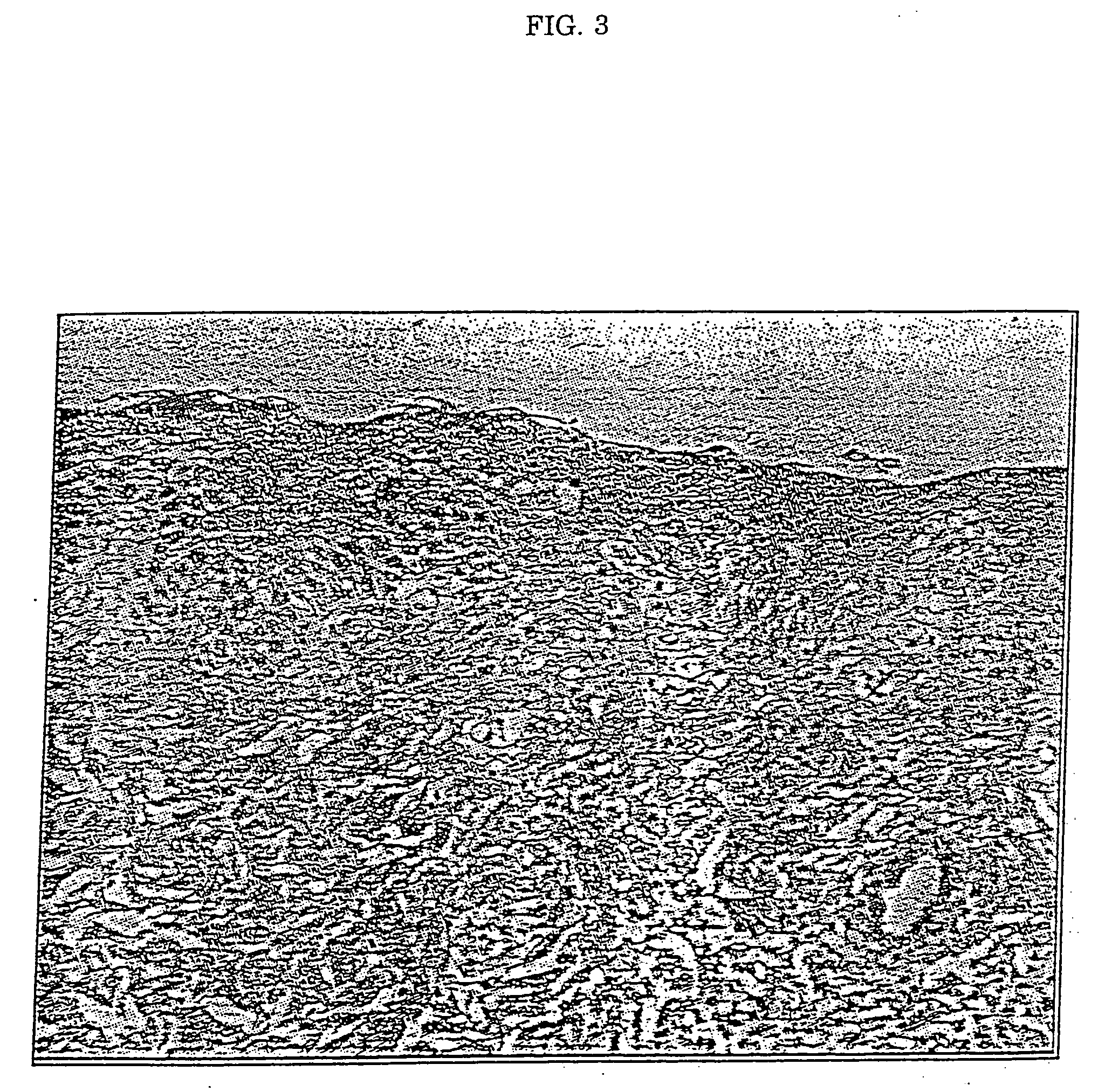 Method for inhibiting bone resorption