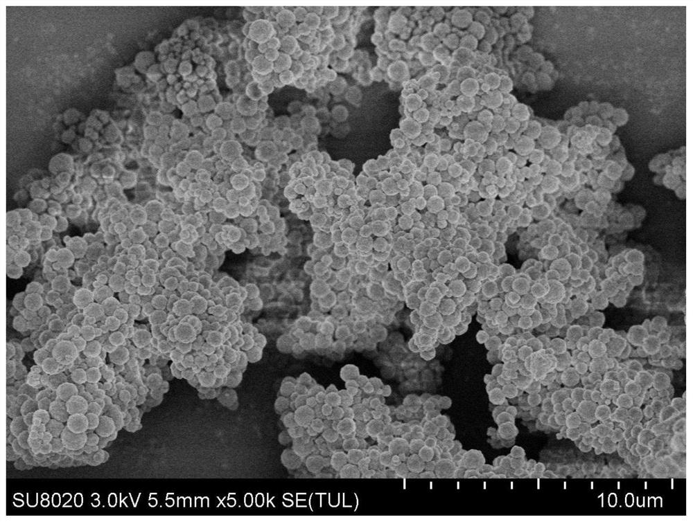 Degradable immunomagnetic bead and preparation method thereof