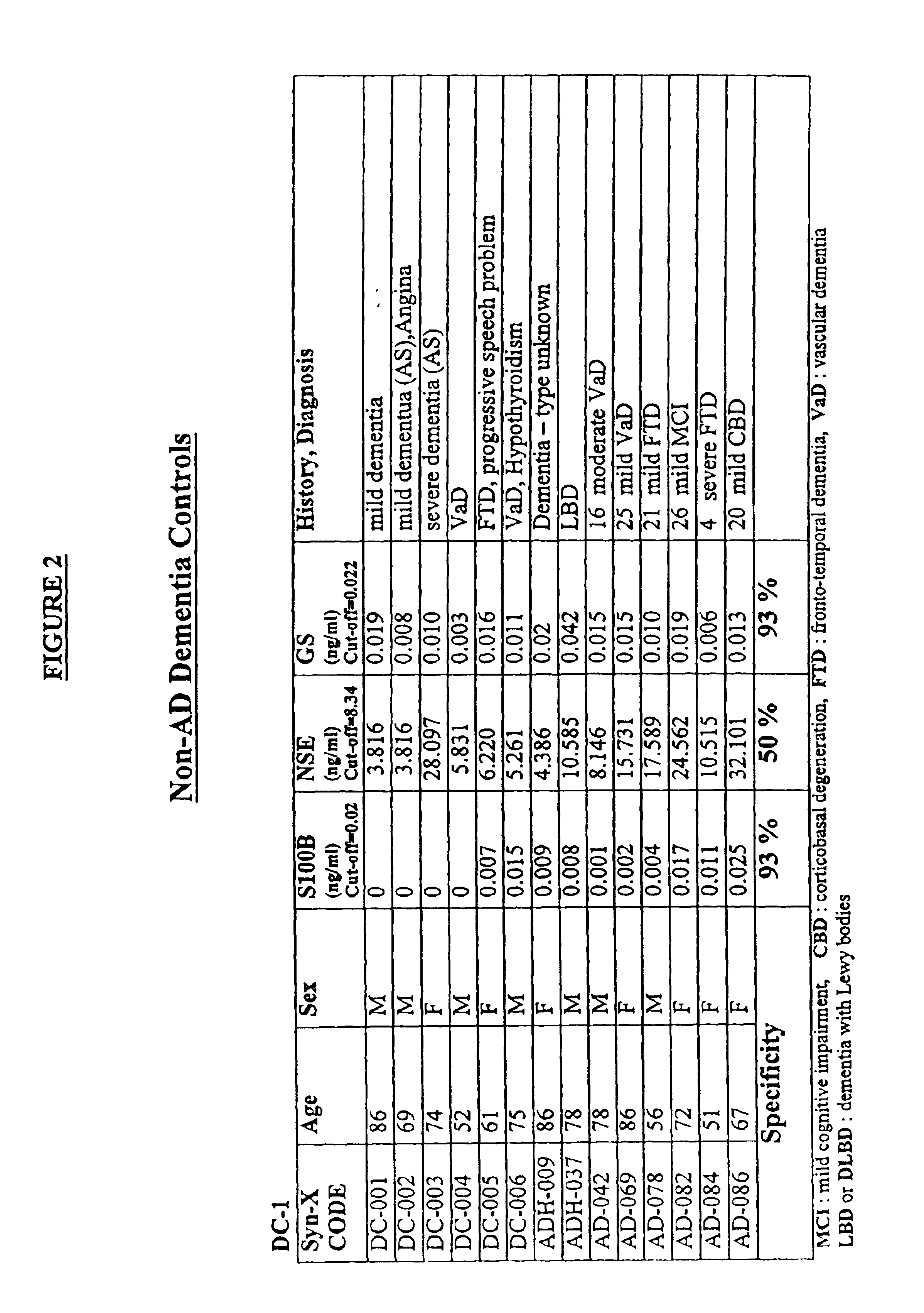 Process for determining the presence of monomeric brain associated human glutamine synthetase in patients exhibiting mild cognitive impairment