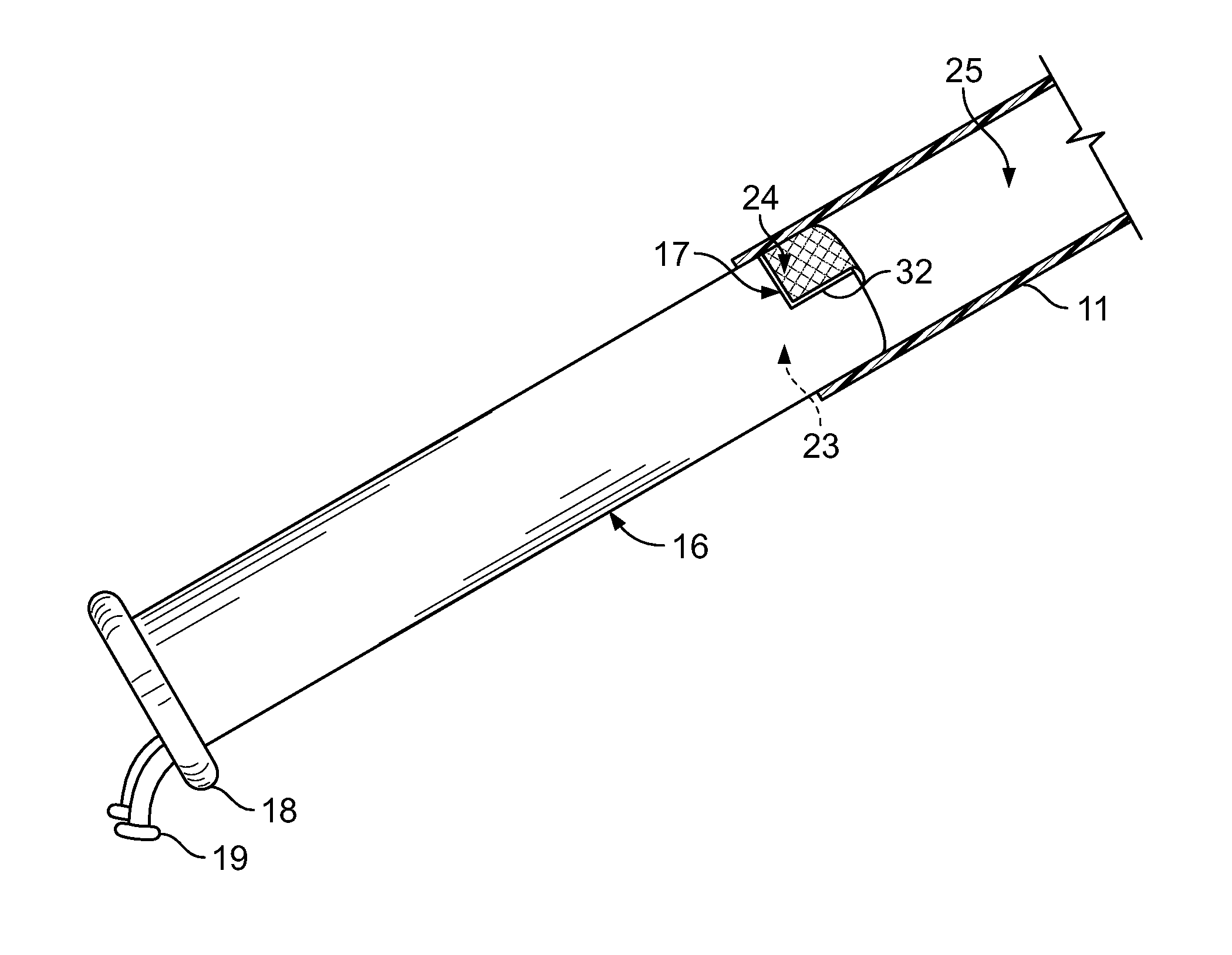 Apparatus and method for organ suspension