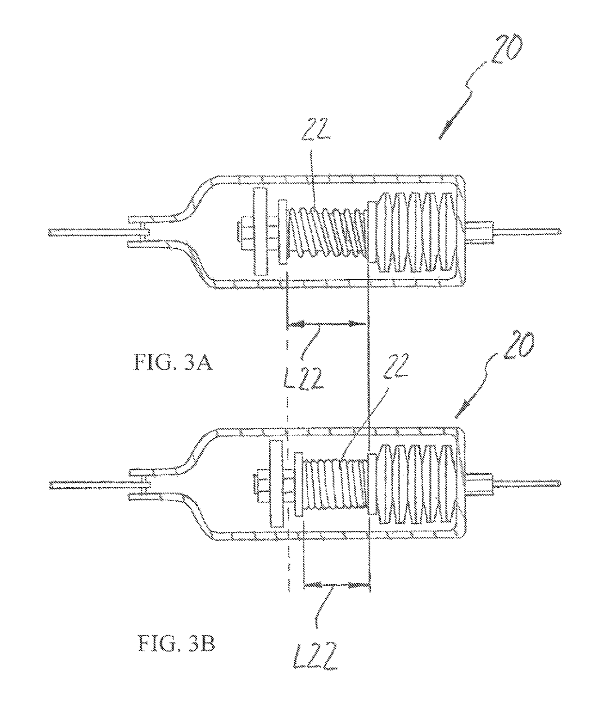 Tensioning unit