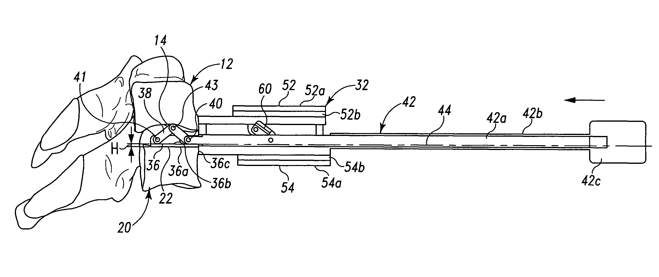 Instruments and techniques for guiding instruments to a spinal column