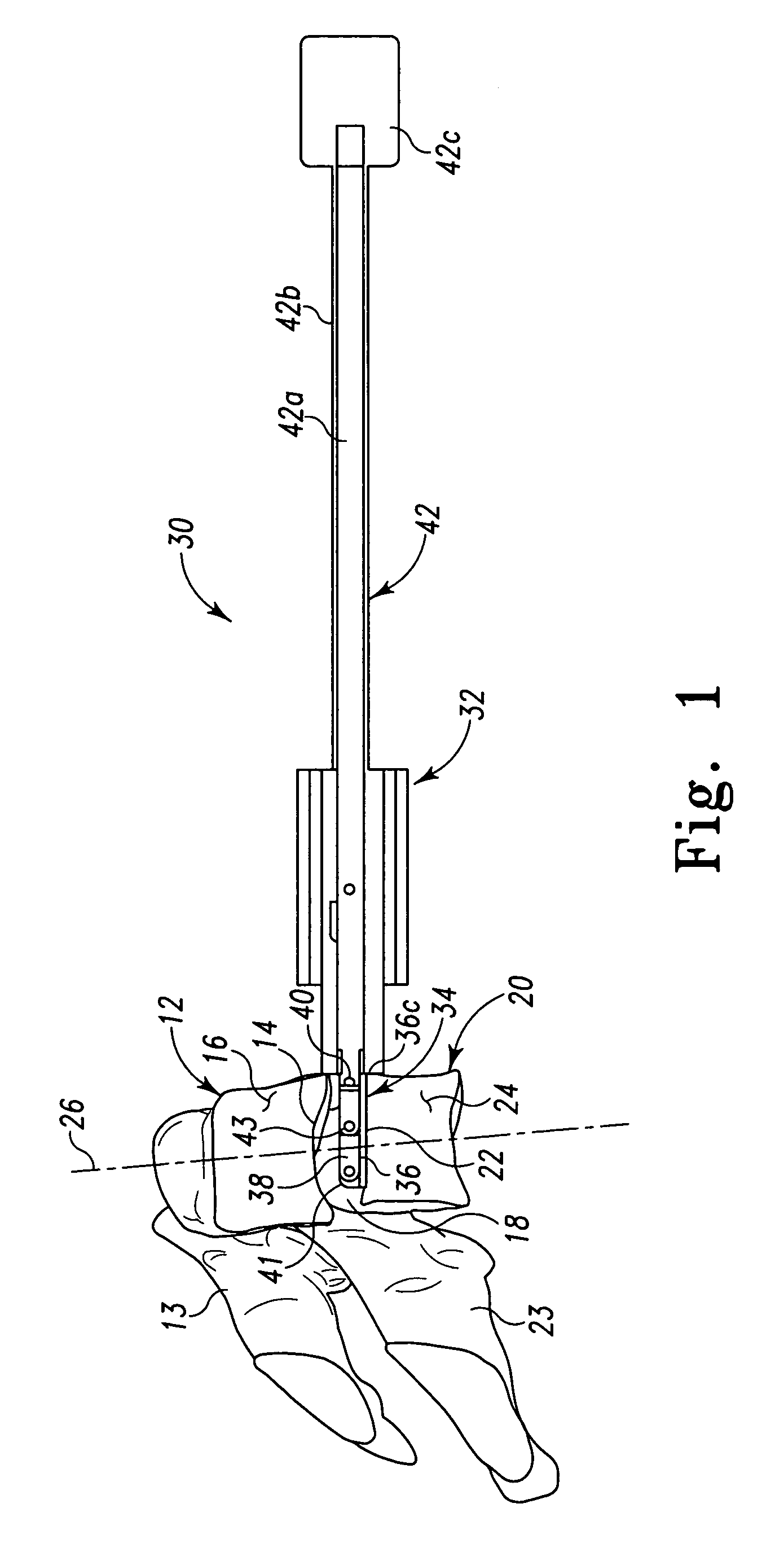 Instruments and techniques for guiding instruments to a spinal column