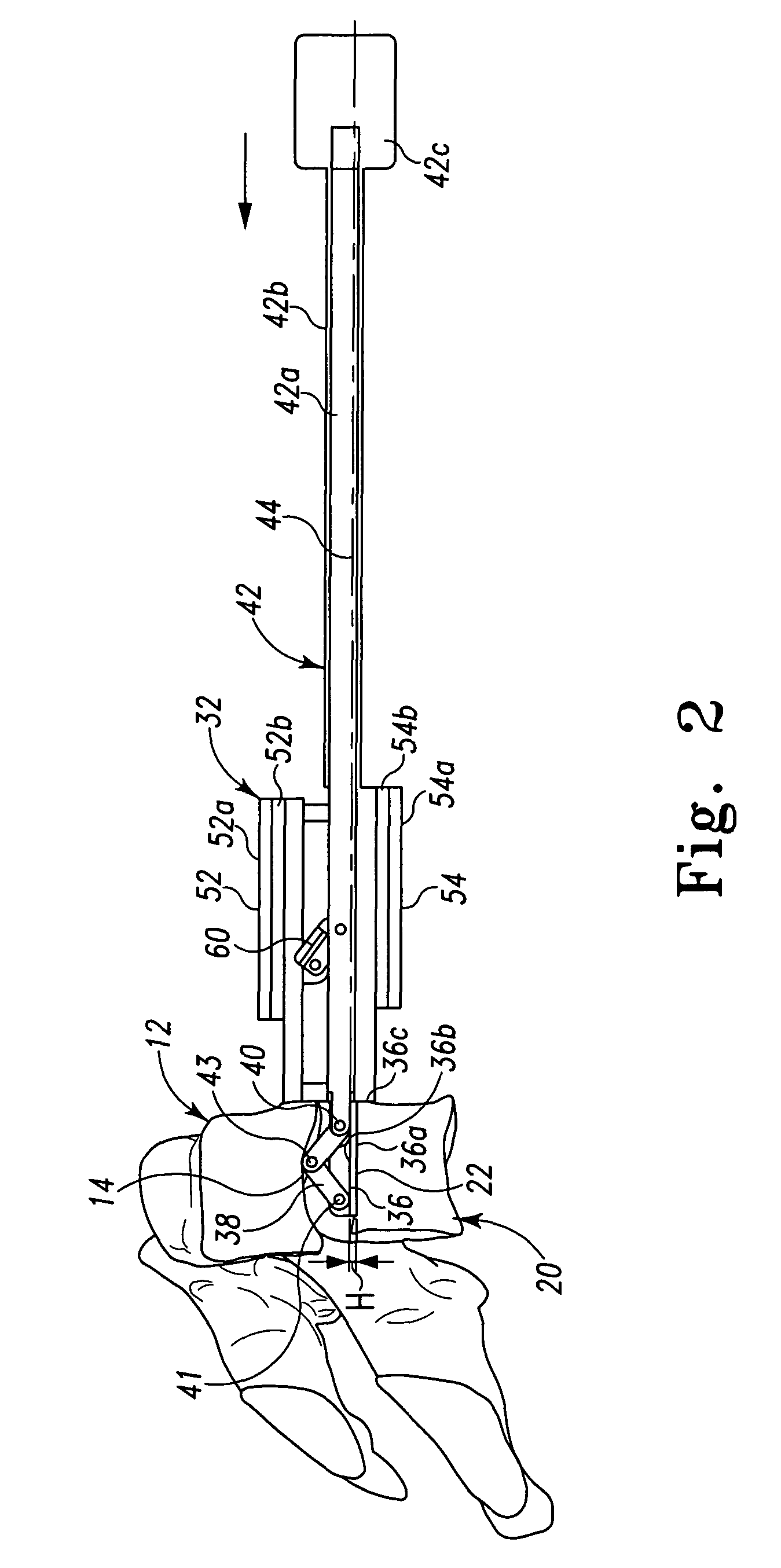 Instruments and techniques for guiding instruments to a spinal column