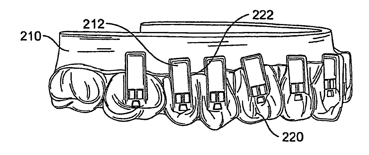 Systems and methods for fabricating a dental template