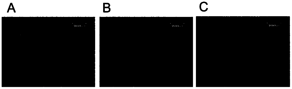 Medicinal agent for inhibiting metastasis of malignant tumor