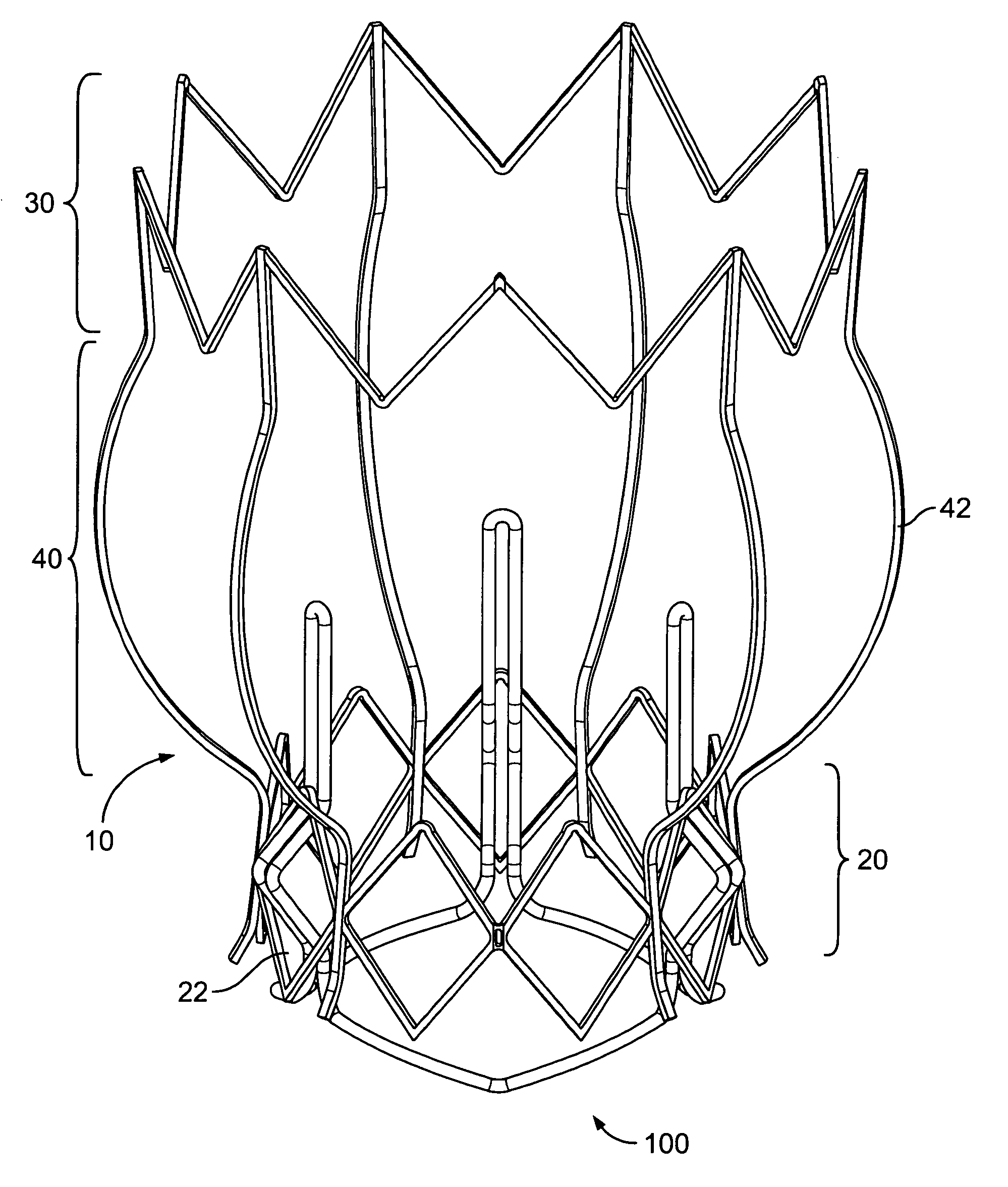 Two-stage collapsible/expandable prosthetic heart valves and anchoring systems