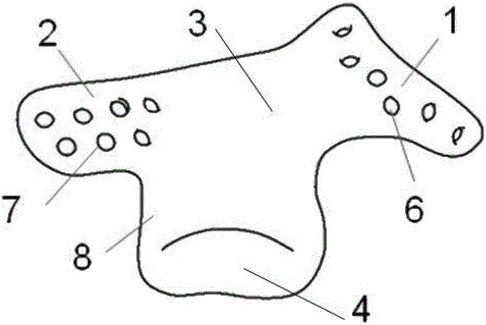 Zygomatic arch temporal-mandibular joint glenoid fossa combined remediation prosthesis