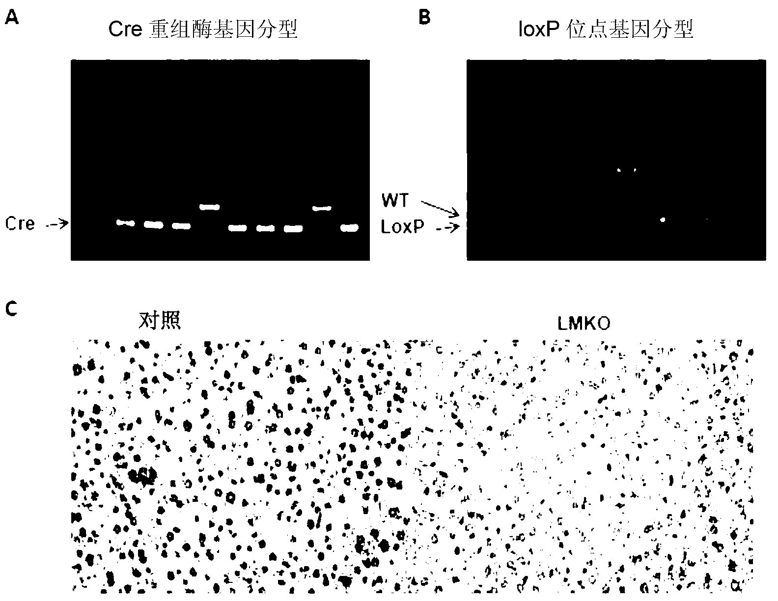 Applications of MEN1 gene and encoding protein thereof