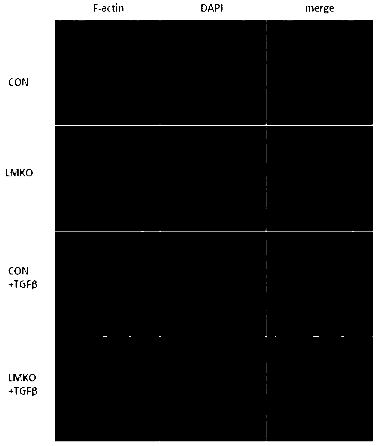 Applications of MEN1 gene and encoding protein thereof