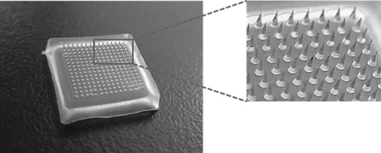 Temperature-sensitive microneedle array patch and preparation method thereof