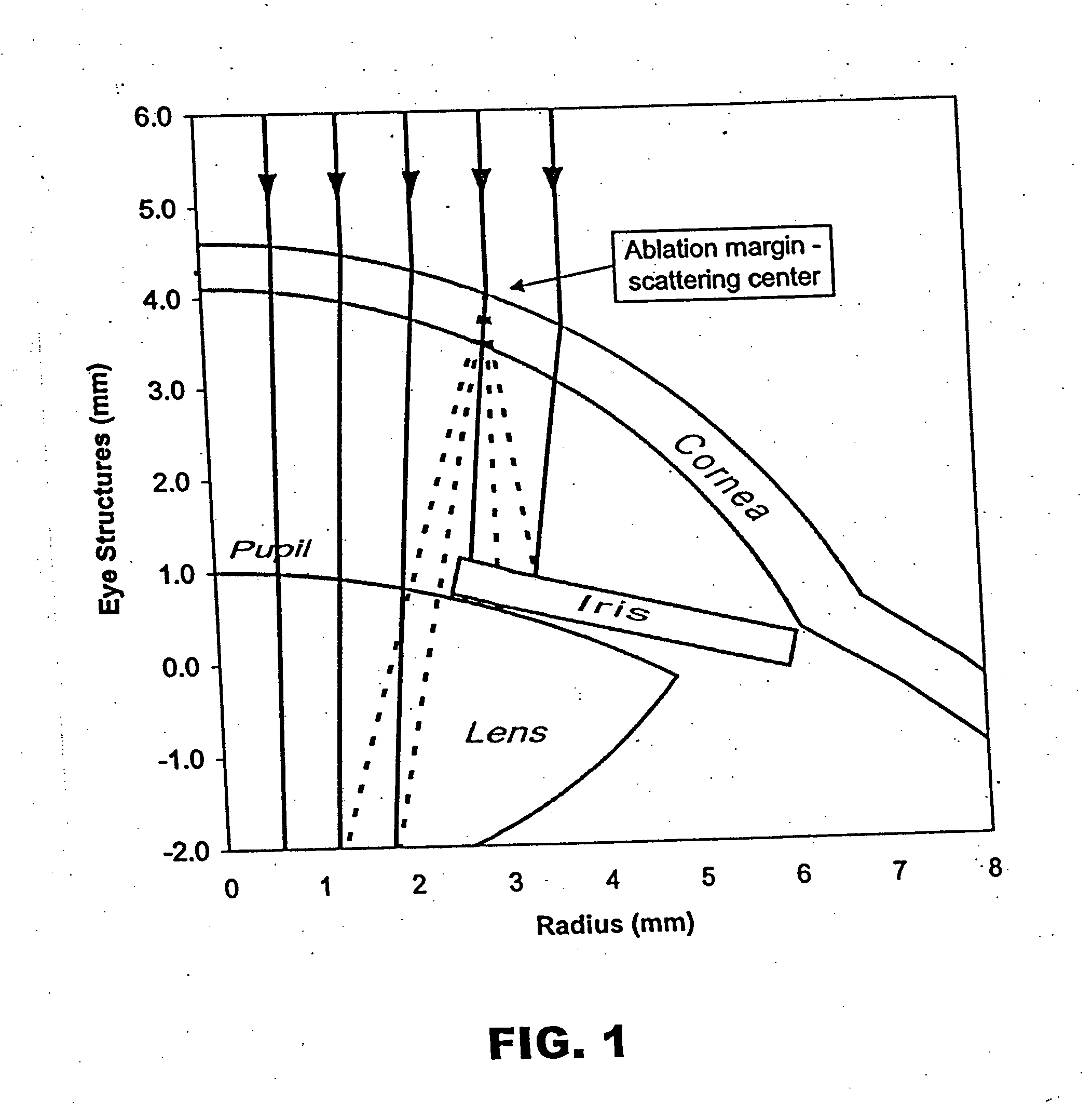 Method and apparatus for reducing visual aberrations