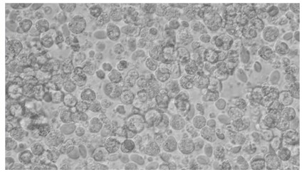 Isolated culture method of primary hepatocytes of chick embryos