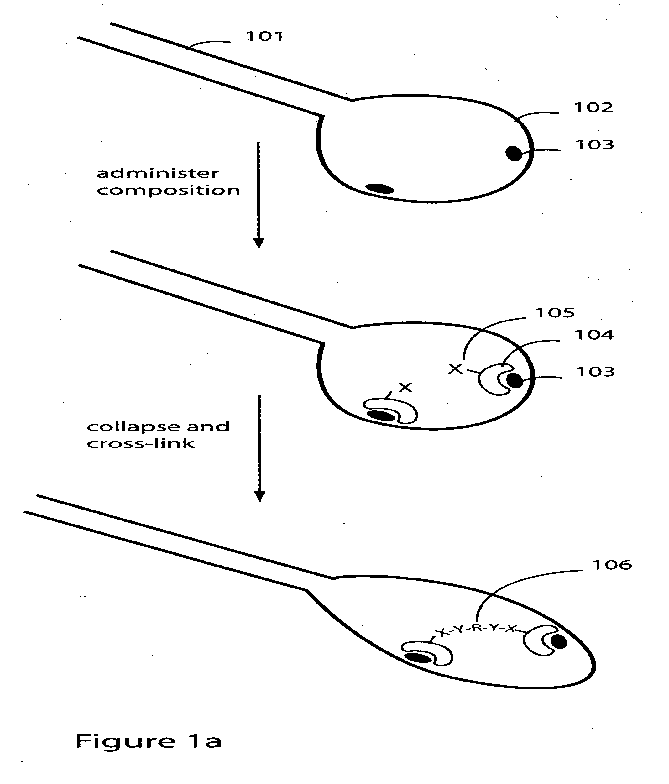 Targeting sites of damaged lung tissue using composition