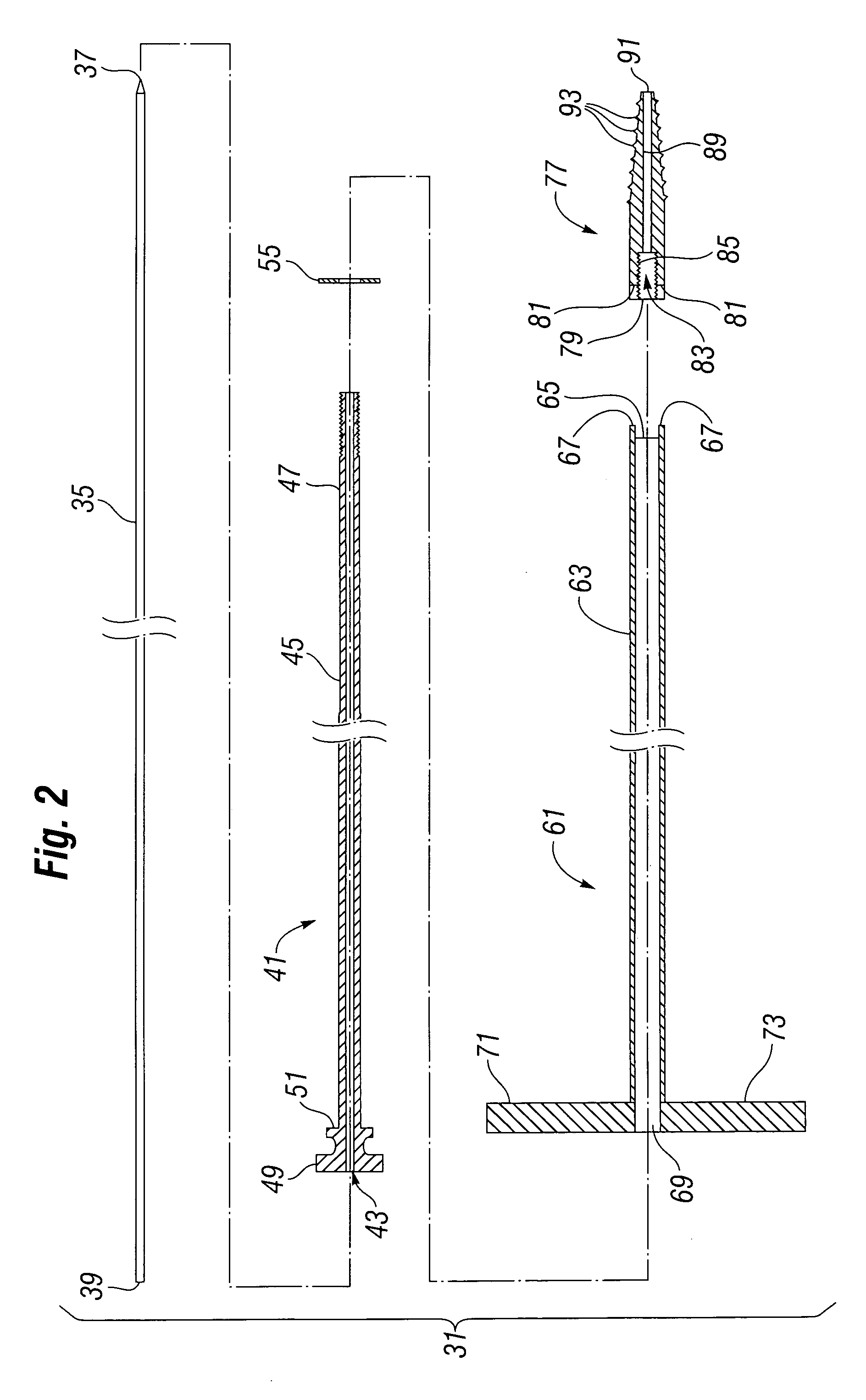 Pedicle dart system