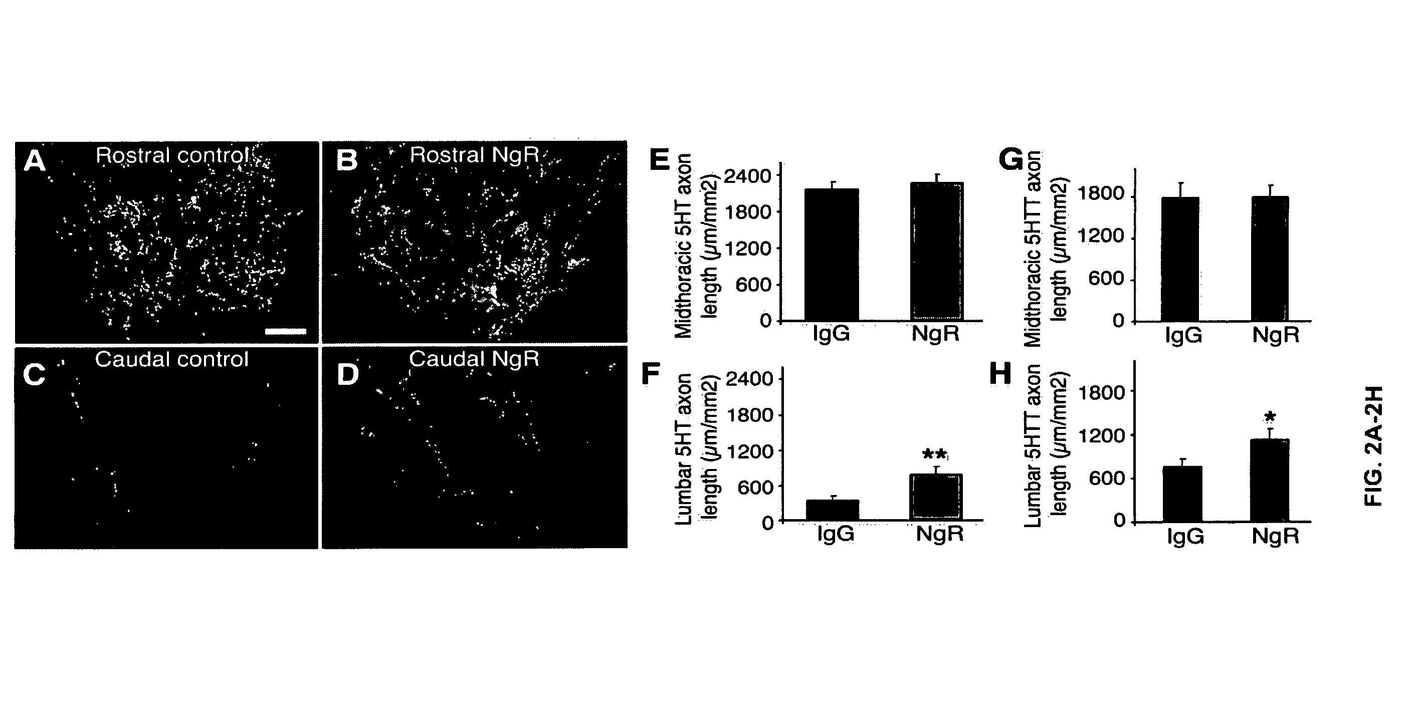 Reactivation of Axon Growth and Recovery in Chronic Spinal Cord Injury