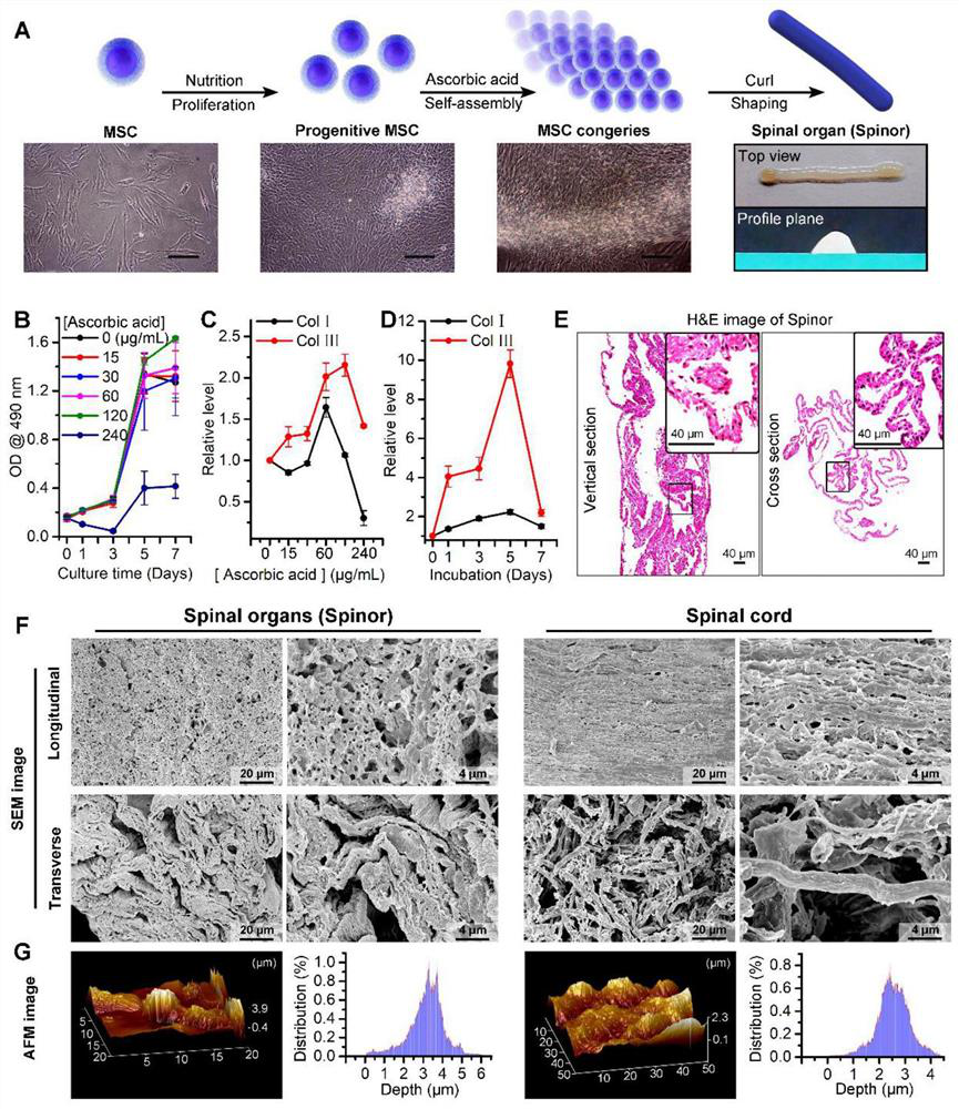 Use of mesenchymal stem cells of dental pulp in obtaining of artificial spinal cord and preparation method for artificial spinal cord