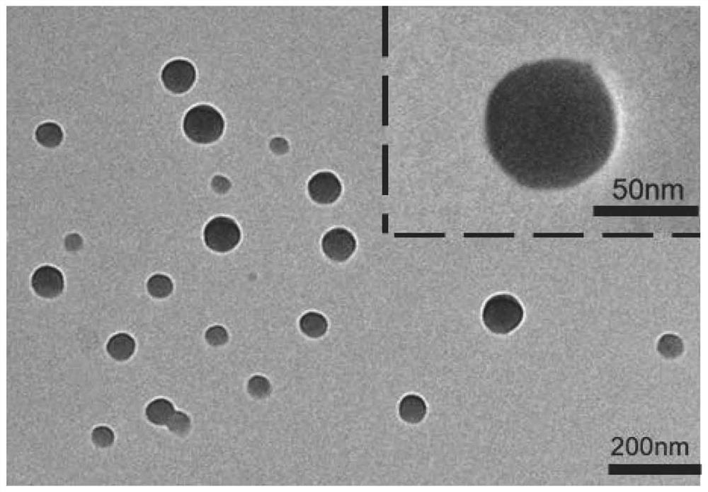 Chloroquine-coated denatured albumin nanoparticles for selectively resisting inflammatory cells as well as preparation method and application of chloroquine-coated denatured albumin nanoparticles