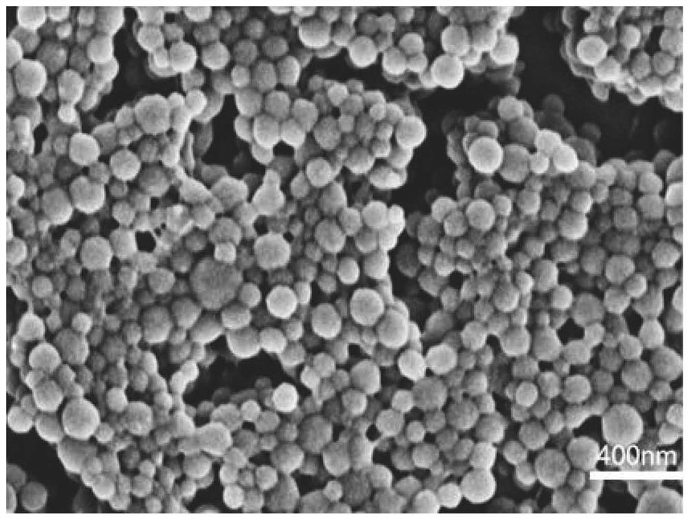 Chloroquine-coated denatured albumin nanoparticles for selectively resisting inflammatory cells as well as preparation method and application of chloroquine-coated denatured albumin nanoparticles