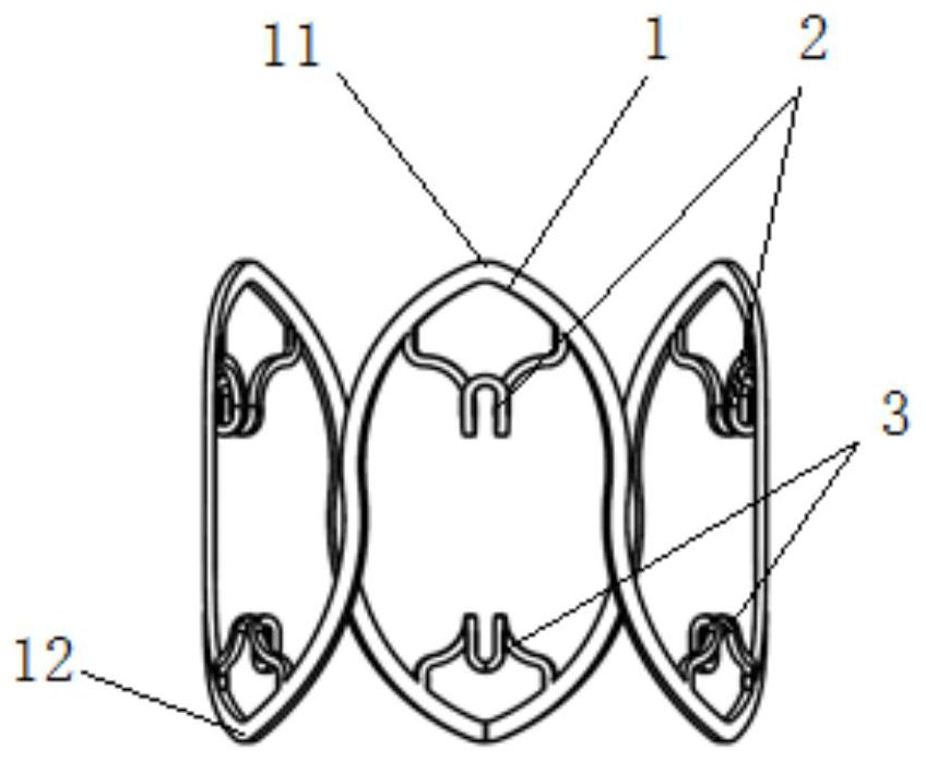 Heart valve replacement prosthesis and support thereof