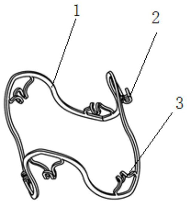 Heart valve replacement prosthesis and support thereof