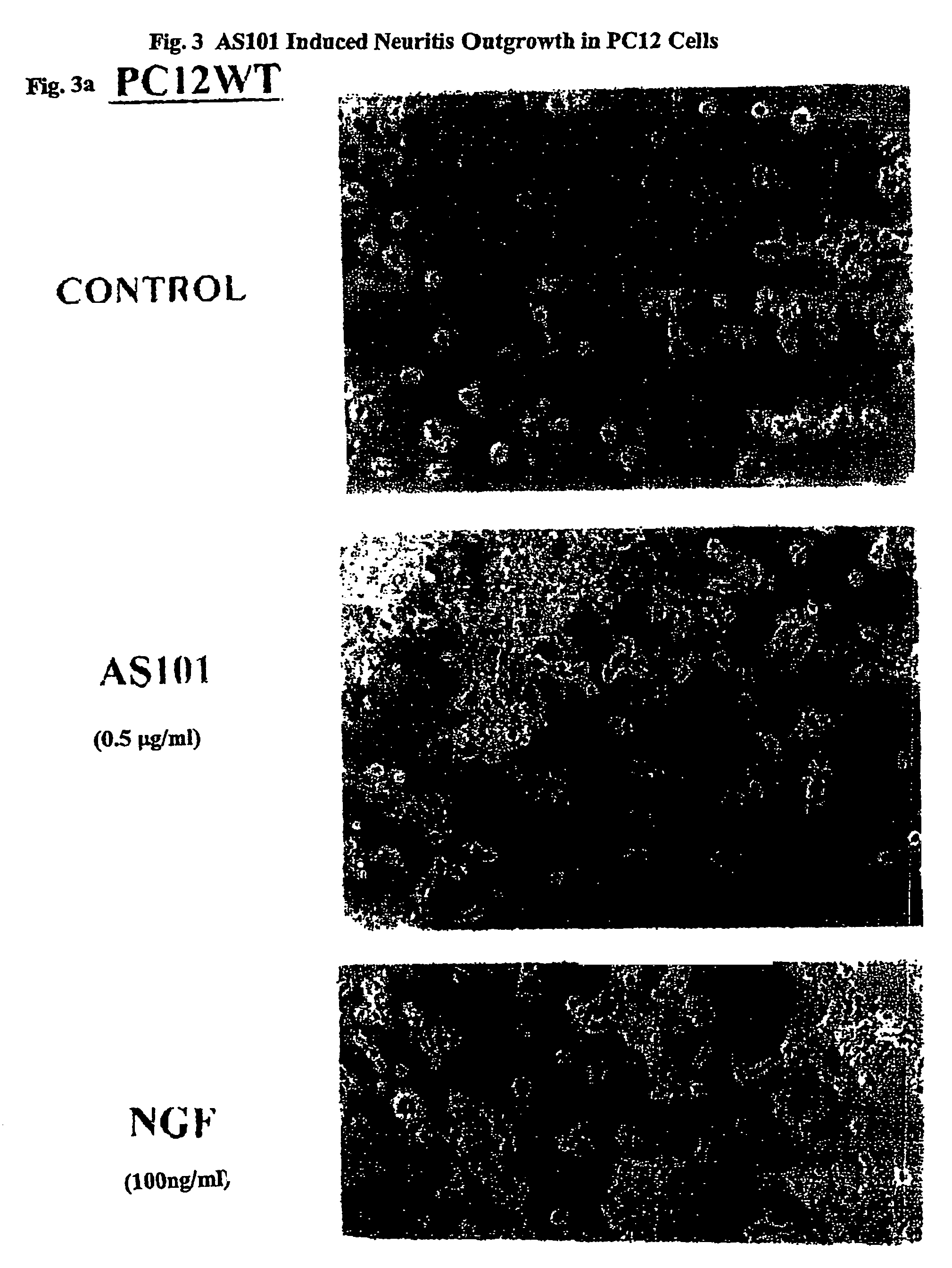 Use of tellurium containing compounds as nerve protecting agents