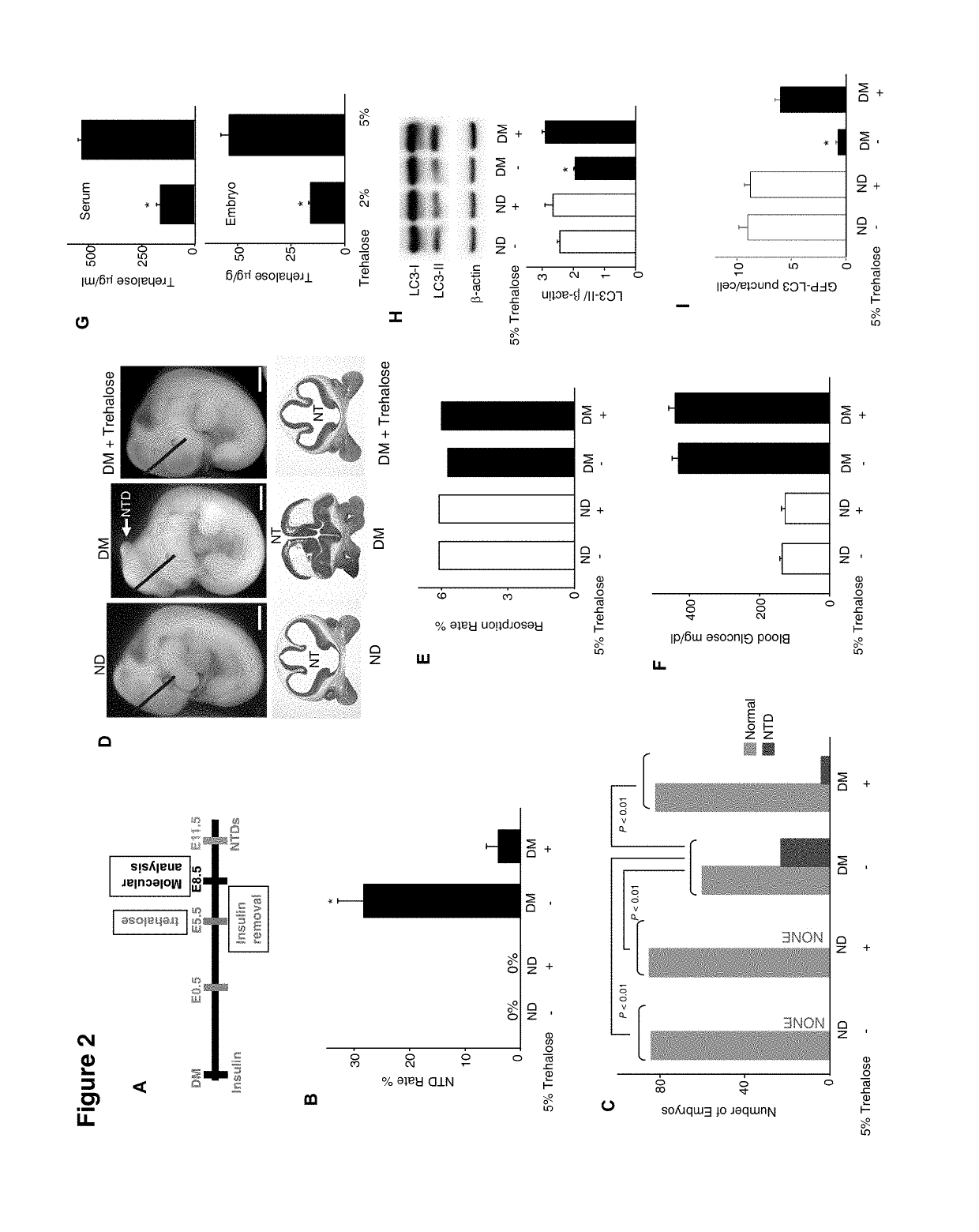 Use of trehalose for prevention of neural tube defects