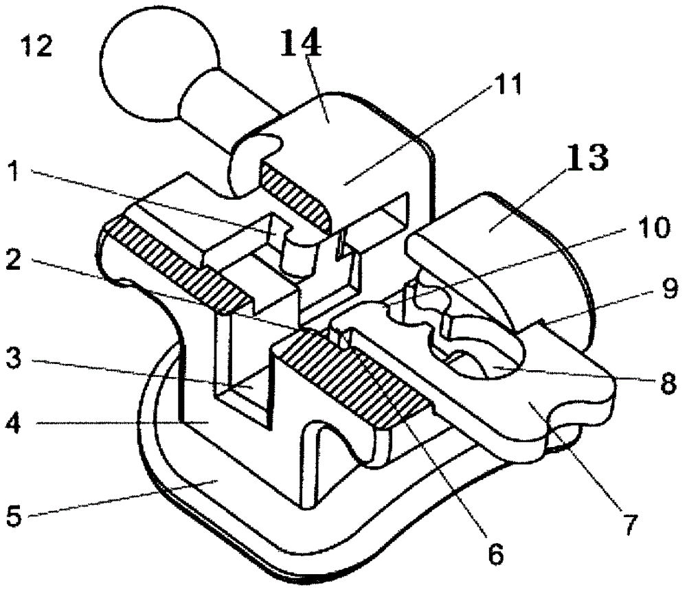 Dental orthopaedics self-ligating bracket