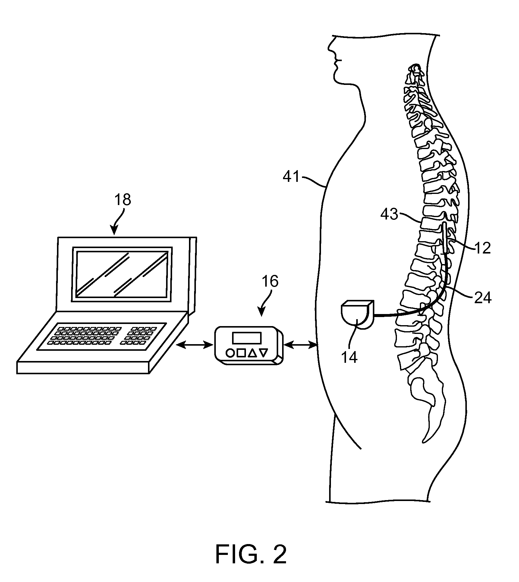 Method for treating depression by indirectly stimulating raphe nuclei