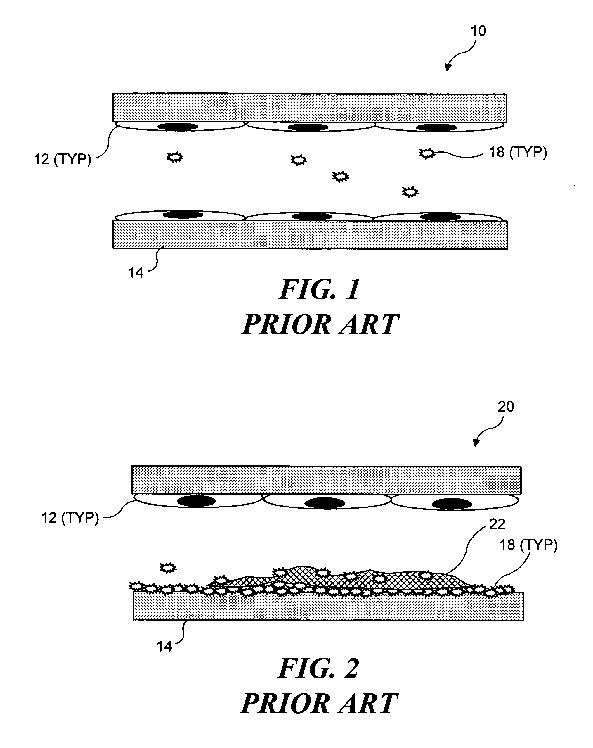 Ultrasound target vessel occlusion using microbubbles