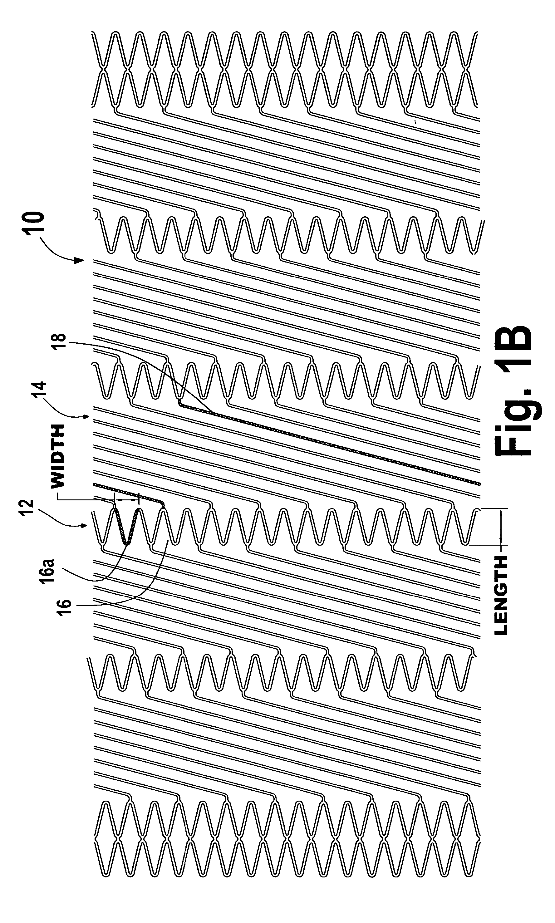 Flexible stent