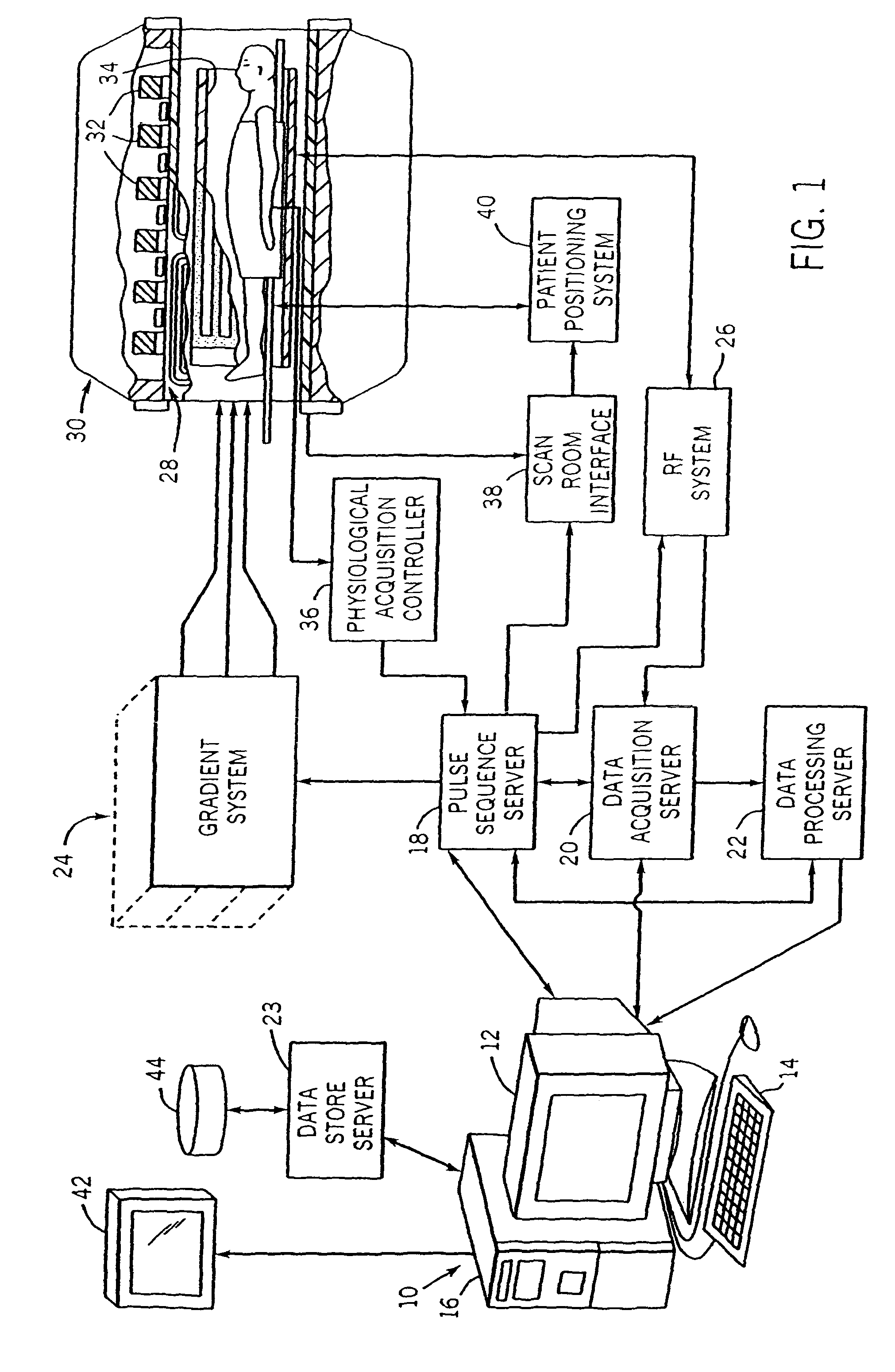 Backprojection reconstruction method for undersampled MR imaging