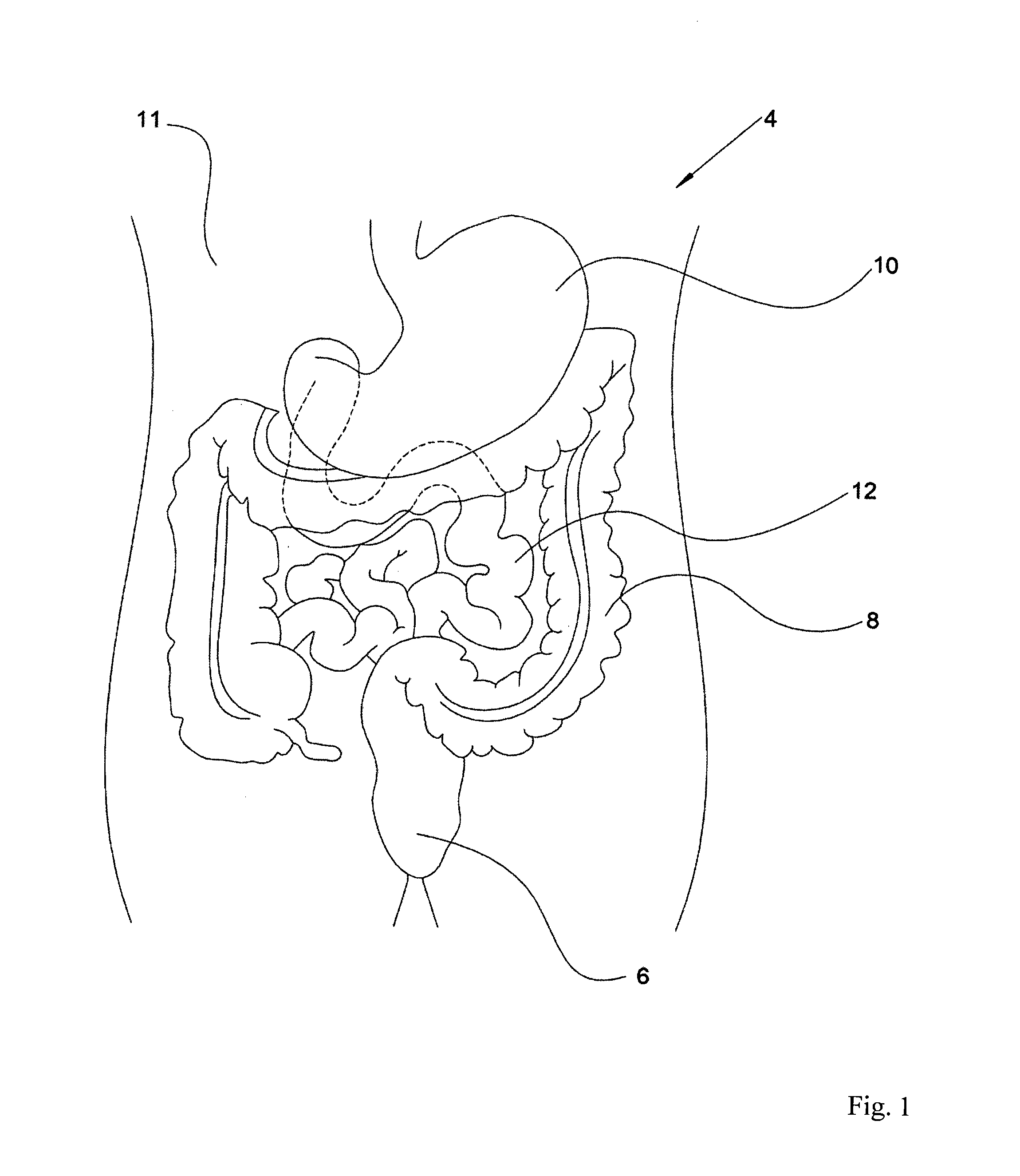 An apparatus for endoscopy