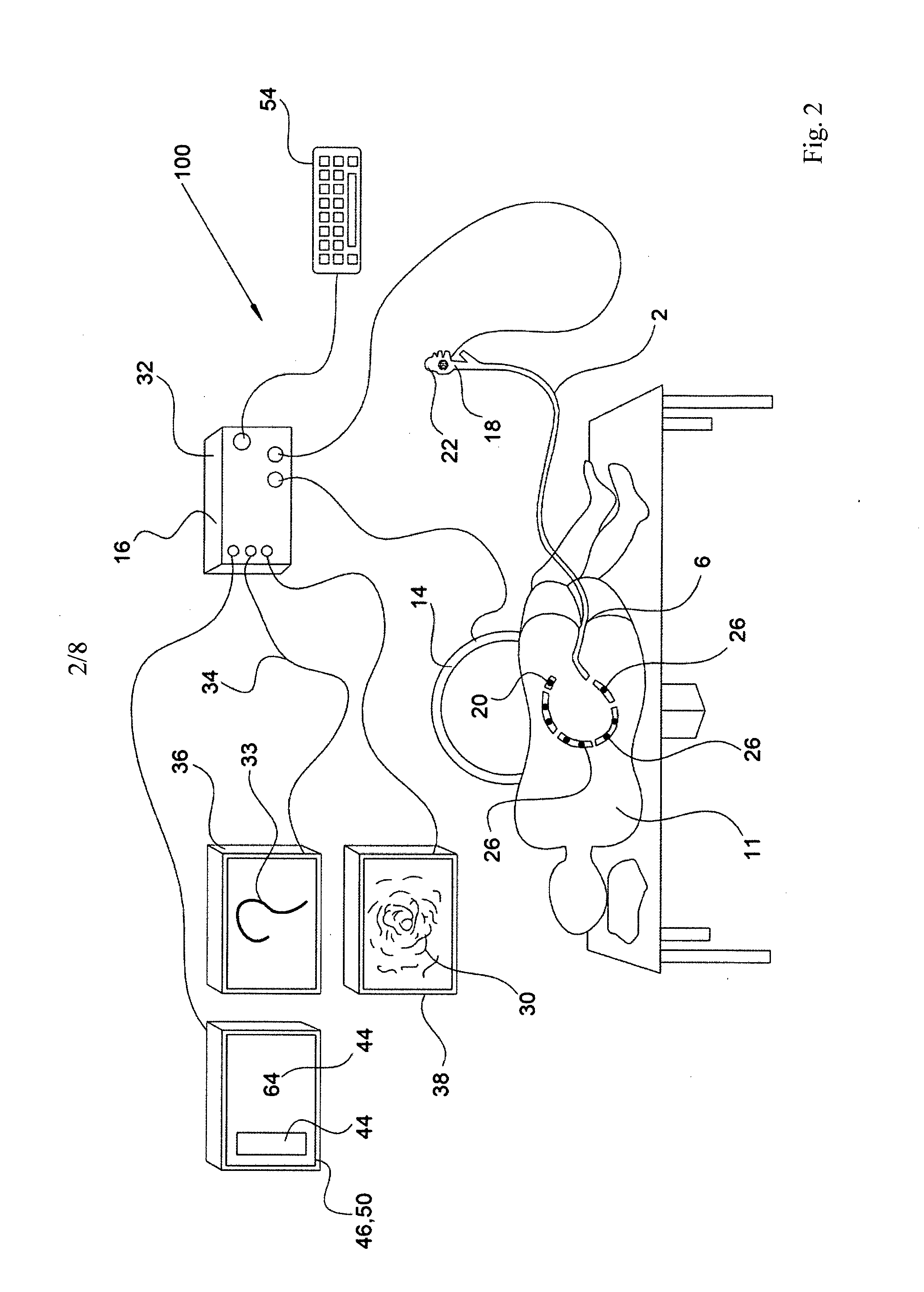 An apparatus for endoscopy