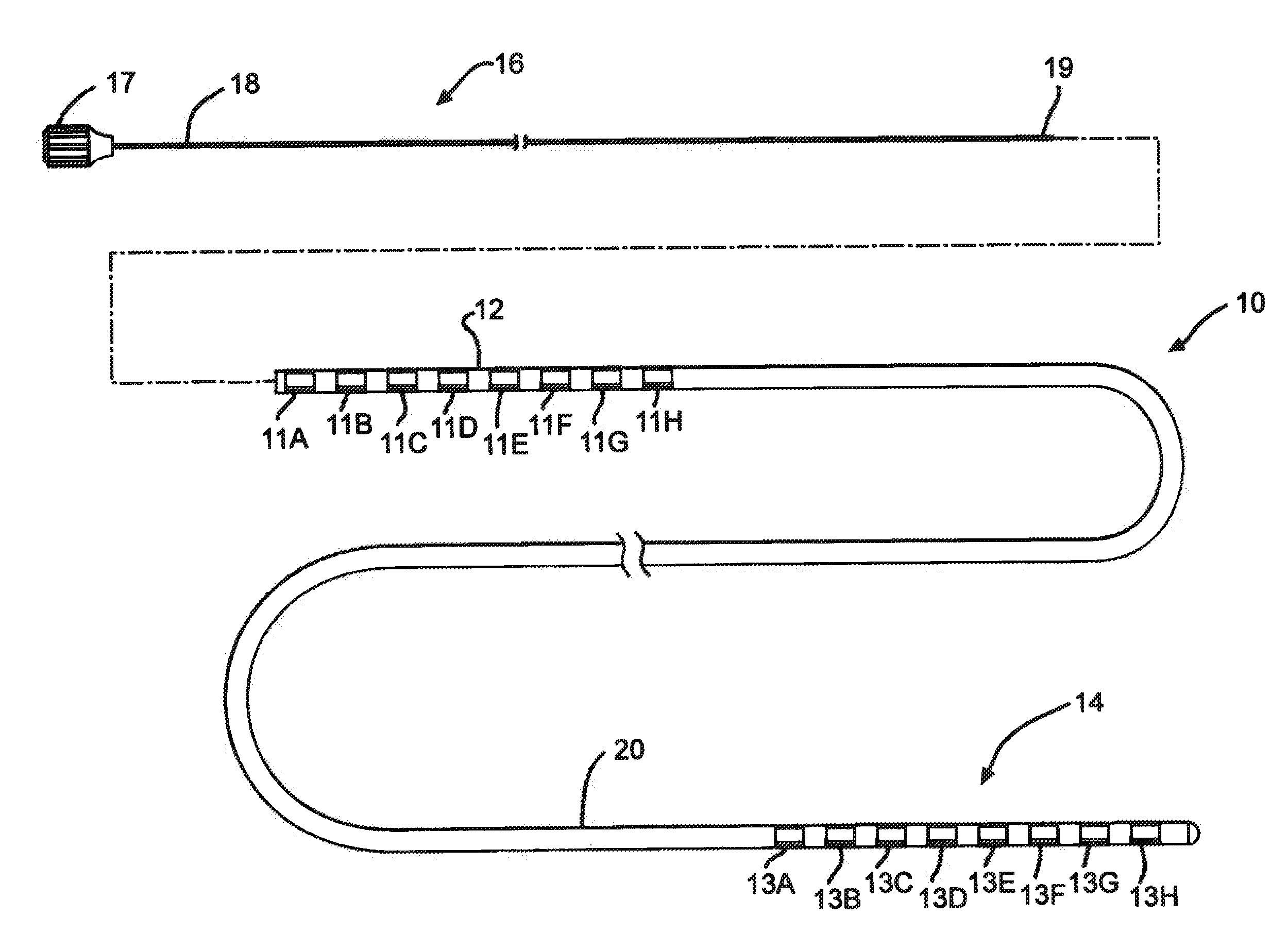 Stimulation lead design and method of manufacture