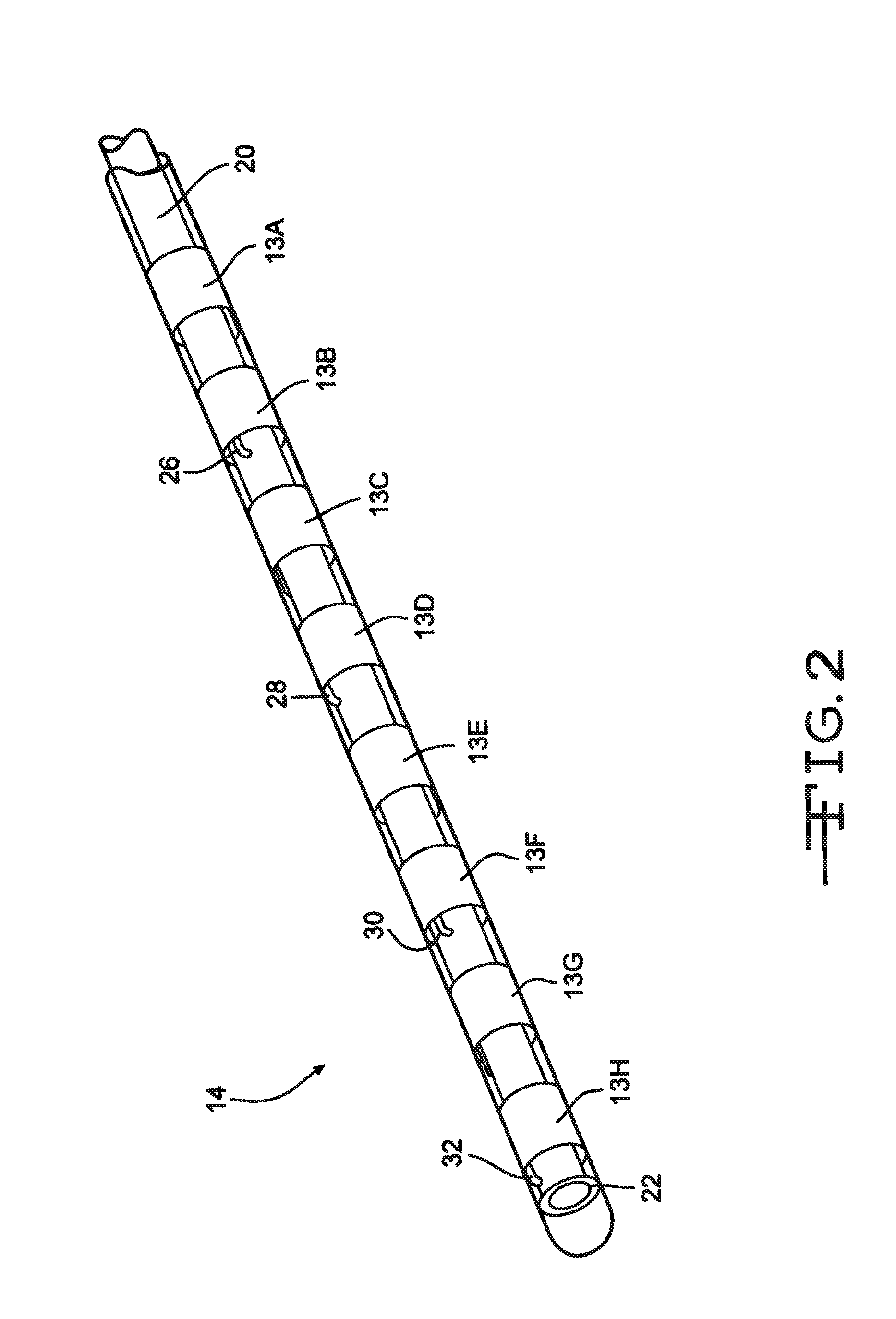 Stimulation lead design and method of manufacture