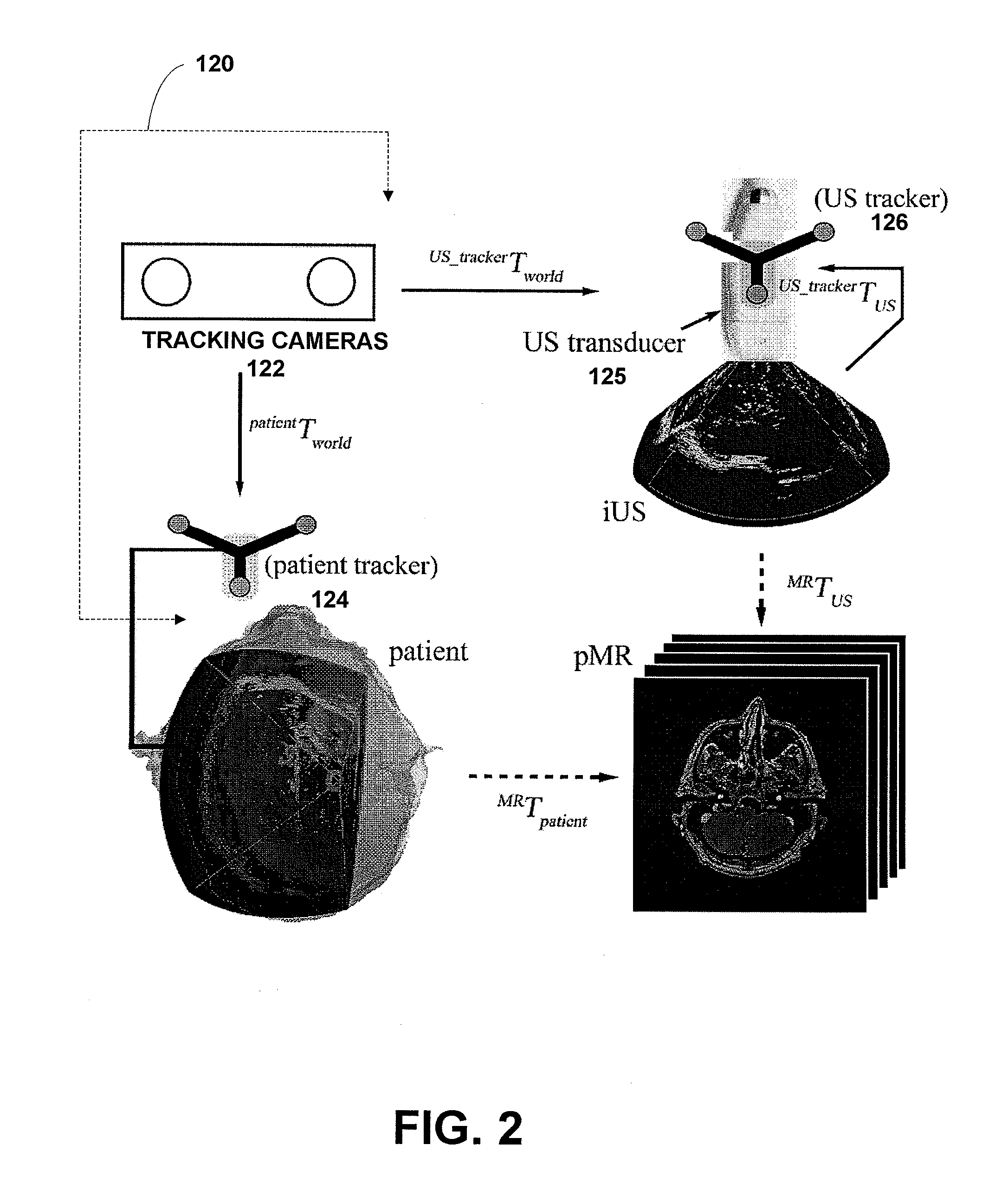 System and method for providing patient registration without fiducials