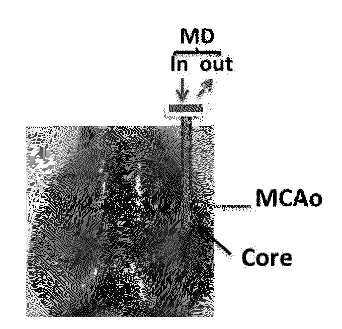 Method for treating brain injury or stroke